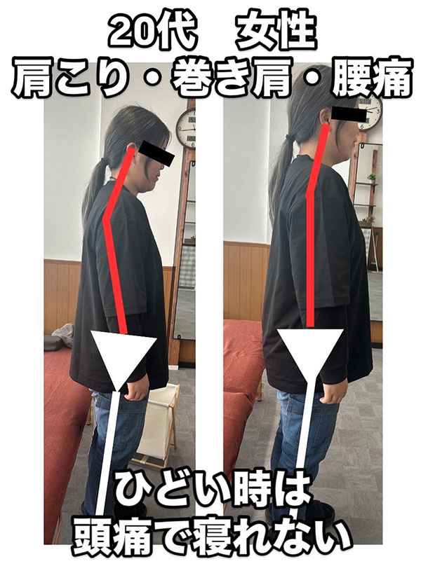 患者さんイラスト