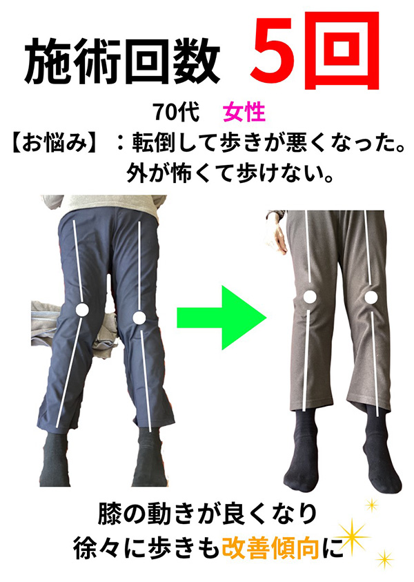 患者さんイラスト